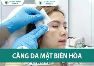 Địa chỉ căng da mặt Biên Hòa uy tín, chất lượng
