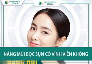 Nâng mũi bọc sụn có vĩnh viễn không, xem ngay để biết