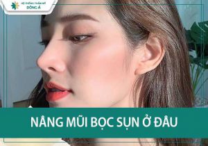 Bật mí nâng mũi bọc sụn ở đâu đẹp và uy tín nhất Hà Nội, HCM