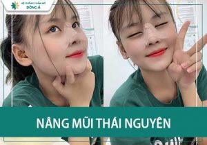 Nên lựa chọn cơ sở nâng mũi nào ở Thái Nguyên