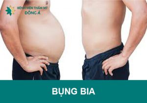 9+ Cách giảm mỡ bụng bia hiệu quả, nhanh chóng cho Nam