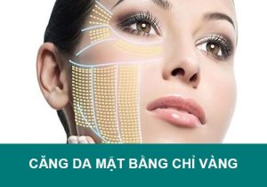 Căng da mặt bằng chỉ vàng có tốt, hiệu quả như lời đồn?