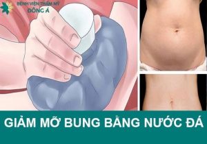 Cách giảm mỡ bụng bằng nước đá lạnh có an toàn, hiệu quả không?