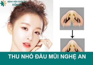 Khám phá địa chỉ thu nhỏ đầu mũi Nghệ An an toàn, uy tín