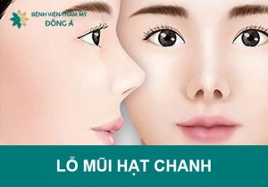 Tướng lỗ mũi hạt chanh là gì? 3 Cách tạo hình lỗ mũi thon đẹp