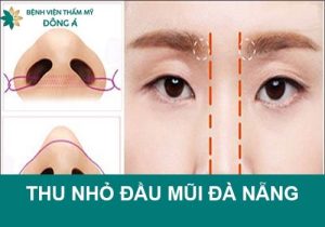 Địa chỉ thu nhỏ đầu mũi Đà Nẵng: Bệnh viện thẩm mỹ Đông Á