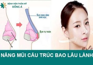 Nâng mũi cấu trúc bao lâu thì lành? Các yếu tố cần lưu ý