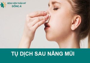 Bị tụ dịch sau nâng mũi: Dấu hiệu, nguyên nhân, cách khắc phục