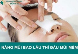 Sau nâng mũi bao lâu thì đầu mũi mềm mại bình thường, đẹp tự nhiên?