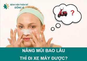 Nâng mũi bao lâu thì đi xe máy được? Mẹo chăm sóc cần nhớ