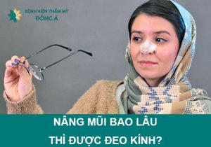 Nâng mũi bao lâu thì được đeo kính? Khi đeo cần chú ý gì?