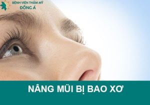 Nâng mũi bị bao xơ là gì? Nguyên nhân & Cách khắc phục hiệu quả