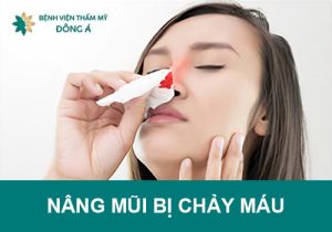 Nâng mũi bị chảy máu do đâu? Có nguy hiểm không? Khắc phục thế nào? 