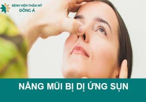 Nâng mũi bị dị ứng sụn: Dấu hiệu nhận biết & Cách khắc phục