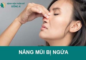 Nâng mũi xong bị ngứa: Nguyên nhân & Cách khắc phục