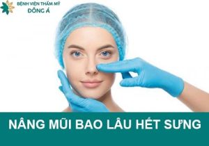 Nâng mũi bao lâu hết sưng đỏ? Cách giảm sưng mũi hiệu quả nhất