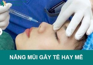 Nâng mũi gây tê hay mê là tốt nhất: Phân tích ưu, nhược điểm