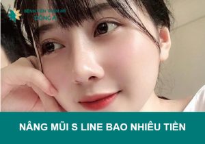 Nâng mũi s line giá bao nhiêu tiền? Bảng chi phí mới nhất