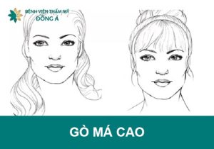 Gò má cao là như thế nào? Tướng phụ nữ/đàn ông? Cách hạ gò má