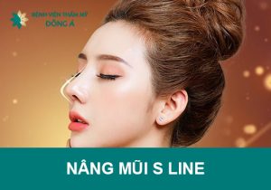 Nâng mũi S Line: kỹ thuật, đặc điểm, bảng giá & quy trình (2022)