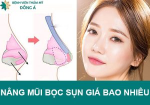 Nâng mũi bọc sụn giá bao nhiêu? Bảng chi phí nâng mũi trọn gói