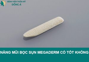 Nâng mũi bọc sụn Megaderm có tốt không? Có nên sử dụng?