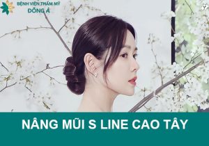 Nâng mũi S line cao Tây đẹp tự nhiên, thon gọn chuẩn Hàn Quốc