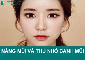 Nâng mũi và thu gọn cánh mũi phẫu thuật cùng lúc được không?