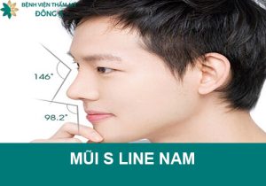 Nâng mũi S line cho nam giới bằng quy trình và công nghệ hiện đại