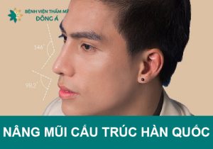 Nâng mũi cấu trúc Hàn Quốc là gì? Mức độ an toàn, chi phí thực hiện,…