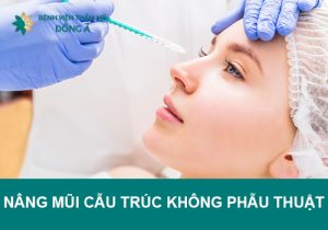 Có nên nâng mũi cấu trúc không phẫu thuật?