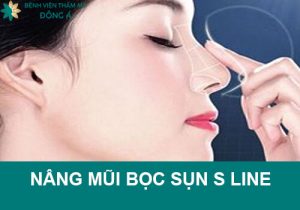 Nâng mũi bọc sụn S line là thế nào? Giá bao nhiêu? Làm ở đâu?