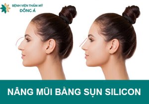 Nâng mũi bằng sụn Silicon là gì? Tốt không? Giữ được bao lâu?