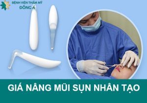 Giá nâng mũi sụn nhân tạo là bao nhiêu? Những yếu tố ảnh hưởng