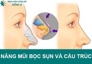 Nâng mũi bọc sụn và cấu trúc có gì khác? Nên chọn kỹ thuật nào?