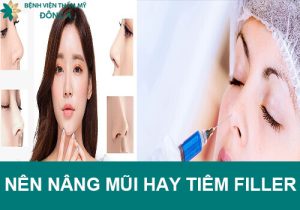 Nên nâng mũi hay tiêm filler? Lựa chọn nào phù hợp cho bạn