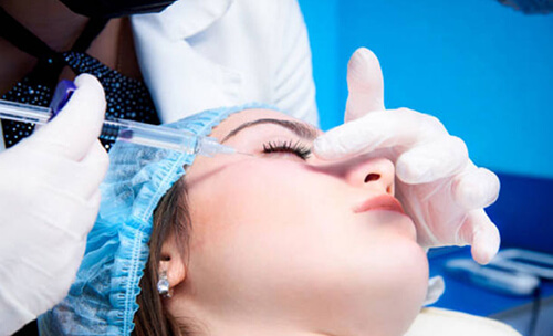 tiêm filler mấy ngày hết sưng