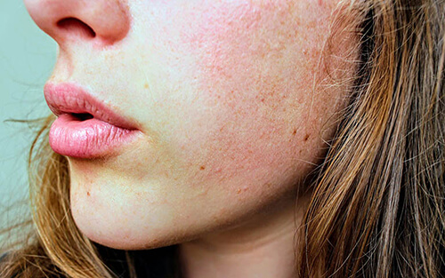tiêm botox có an toàn không