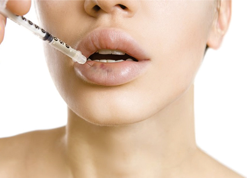 tiêm filler có bị sưng không