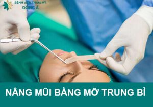 Nâng mũi bằng mỡ trung bì: Giải pháp cải thiện dáng mũi hiệu quả