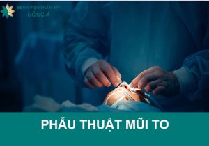 Phẫu thuật sửa đầu mũi to đẹp chuẩn Hàn và những điều liên quan