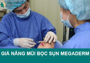 Giá nâng mũi bọc sụn Megaderm bao nhiêu? Yếu tố nào tác động?