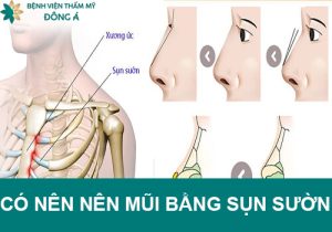 Có nên nâng mũi bằng sụn sườn? Sửa mũi sụn sườn ở đâu uy tín?