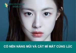 Có nên nâng mũi và cắt mí mắt cùng lúc? Tư vấn từ chuyên gia