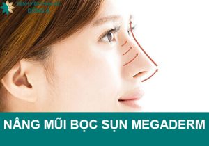 Nâng mũi bọc sụn Megaderm: Liệu pháp thần thánh tạo hình mũi