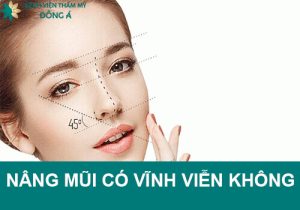 Nâng mũi có vĩnh viễn không? Kỹ thuật sửa mũi nào đẹp vĩnh viễn?