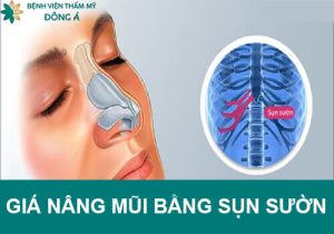 Giá nâng mũi bằng sụn sườn bao nhiêu? Yếu tố  nào ảnh hưởng?