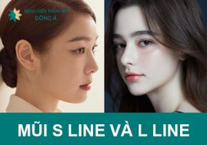 Phân biệt dáng nâng mũi S Line và L Line