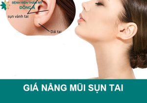 Giá nâng mũi nâng mũi bọc sụn tai hết bao nhiêu tiền?