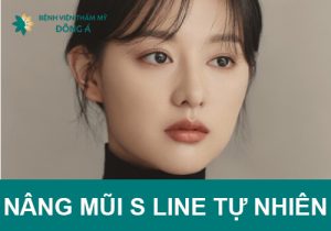 Nâng mũi S Line tự nhiên – nét đẹp đặc trưng người Á Đông